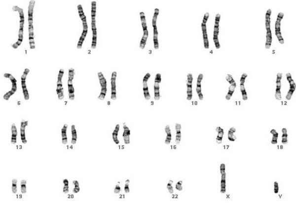 Chromosomes